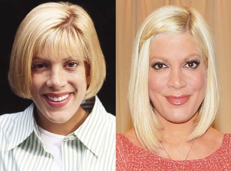 A picture of Tori Spelling from the past (left) looks shockingly different from the present (right).